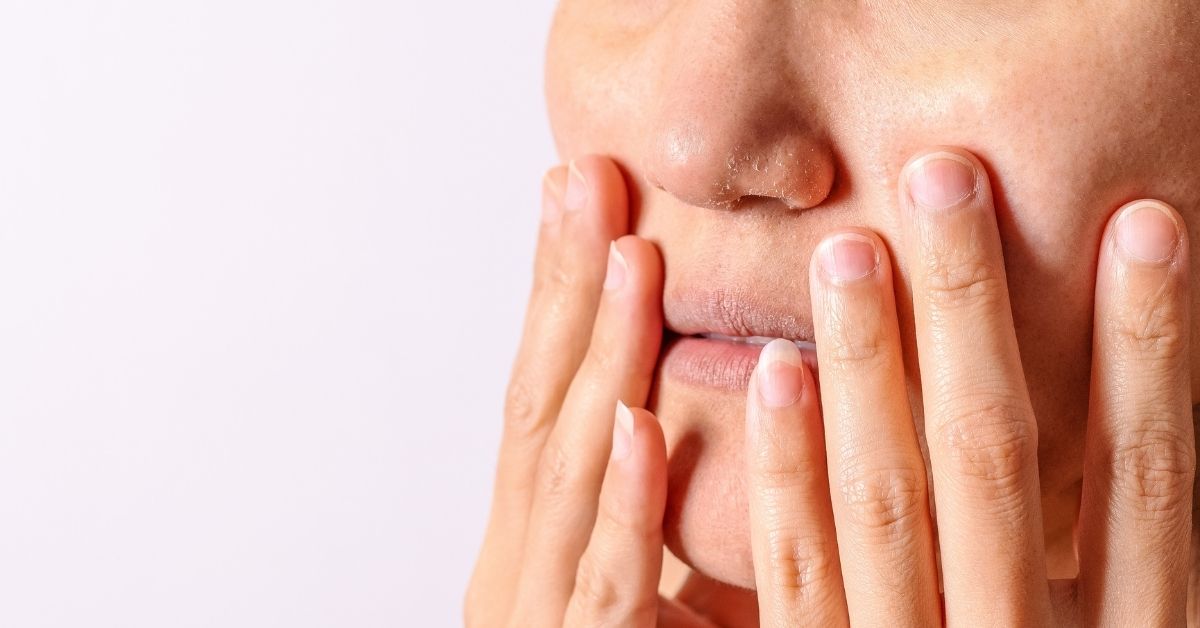 10 Cara Ampuh agar Bibir dan Kulit Tidak Kering saat Puasa