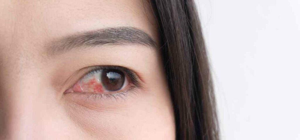 Apa Itu Gangguan Penglihatan? Gangguan pada indra penglihatan adalah penyakit mata yang cukup sering dialami oleh masyarakat.  Ada beberapa hal yang menyebabkan penyakit mata mulai dari iritasi, mata gatal, mata buram, katarak, hingga kebutaan. 