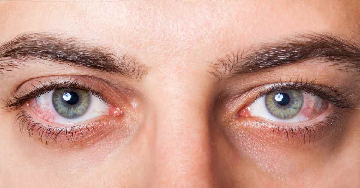 11 Jenis Gangguan Penglihatan, Ini Cara Mudah Mengatasinya!