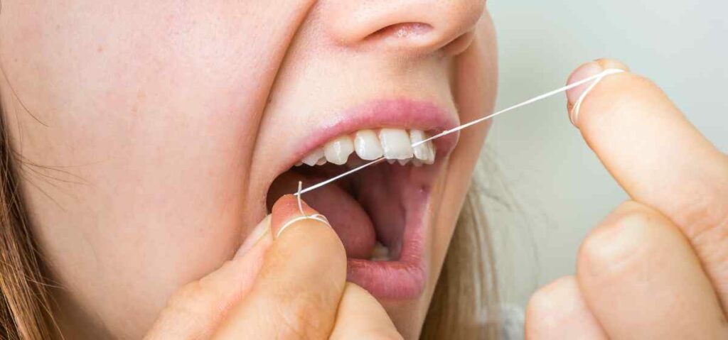 Plak dan sisa makanan yang tidak bersih lama-lama bisa membuat permukaan gigi berwarna kuning. Nah, flossing adalah salah satu cara yang bisa dipakai untuk mengatasi hal ini.