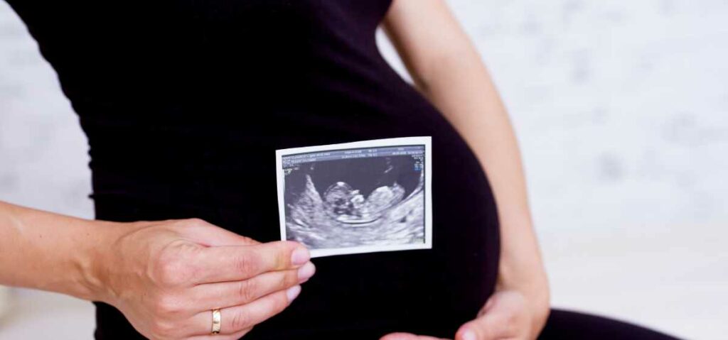 Pemeriksaan USG dinilai akurat sebagai cara menghitung usia kehamilan.