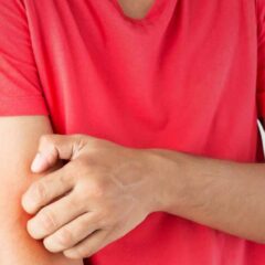 Alami, 8 Cara Ampuh Mengusir Nyamuk di Rumah