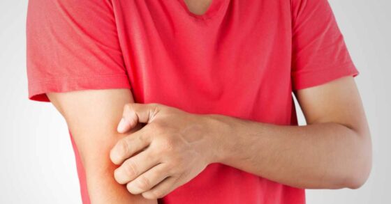Alami, 8 Cara Ampuh Mengusir Nyamuk di Rumah