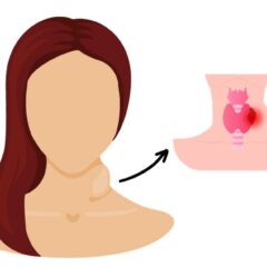 15+ Penyebab Benjolan di Leher, Wajib Periksa!