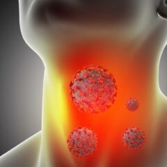 Faringitis (Radang Tenggorokan) – Gejala, Penyebab, Cara Mengobati