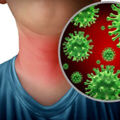 Apakah Radang Tenggorokan Bisa Menular? Begini Penjelasannya