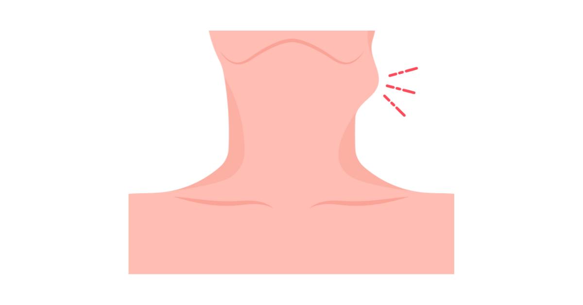Benjolan di leher bisa terjadi karena keratosis aktinik.