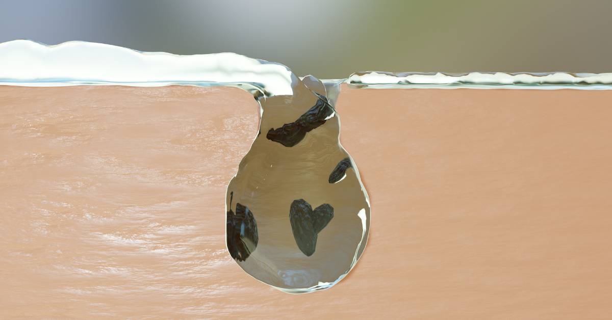 Manfaat double cleansing yaitu bisa membantu menyerap skincare lebih optimal, lho!