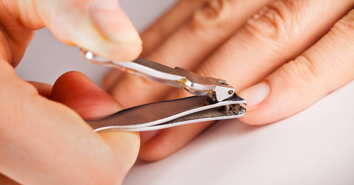 Salah satu cara menghilangkan cacar air dengan cepat adalah menggunting kuku.