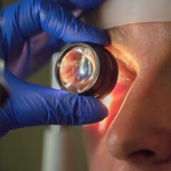 Operasi Katarak dengan BPJS Kesehatan, Simak Langkah dan Persyaratannya