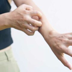 7 Cara Menghilangkan Gatal pada Kulit yang Tak Kunjung Sembuh