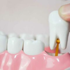 5 Cara agar Gigi yang Goyang Cepat Copot