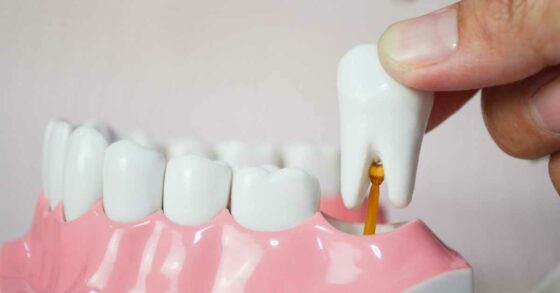 5 Cara agar Gigi yang Goyang Cepat Copot
