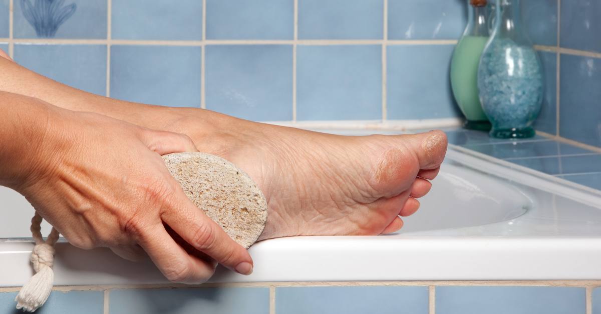 Cara menghilangkan kapalan salah satunya adalah menggunakan batu apung.