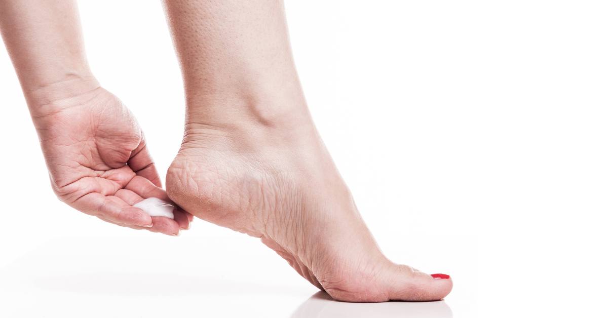 Cara menghilangkan kapalan salah satunya adalah mengoleskan krim eksfoliasi.