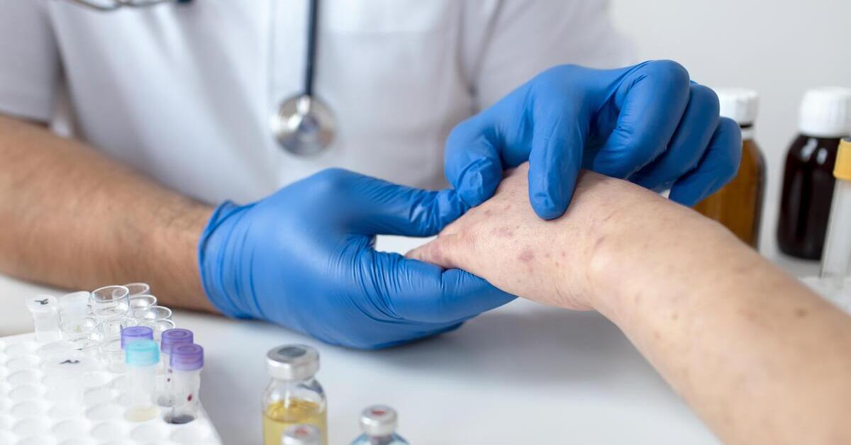 Macam-Macam Alergi Kulit