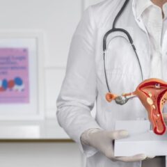 Apa Itu Kista? Berikut Penyebab, Gejala, dan Cara Mengobatinya