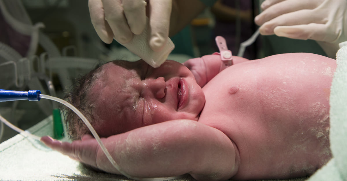 Penyebab Bayi Lahir Prematur