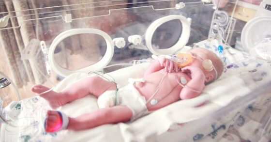 5 Penyebab Bayi Lahir Prematur dan Penanganannya