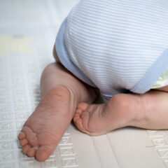 Kenali, 5 Jenis Ruam yang Sering Terjadi pada Bayi