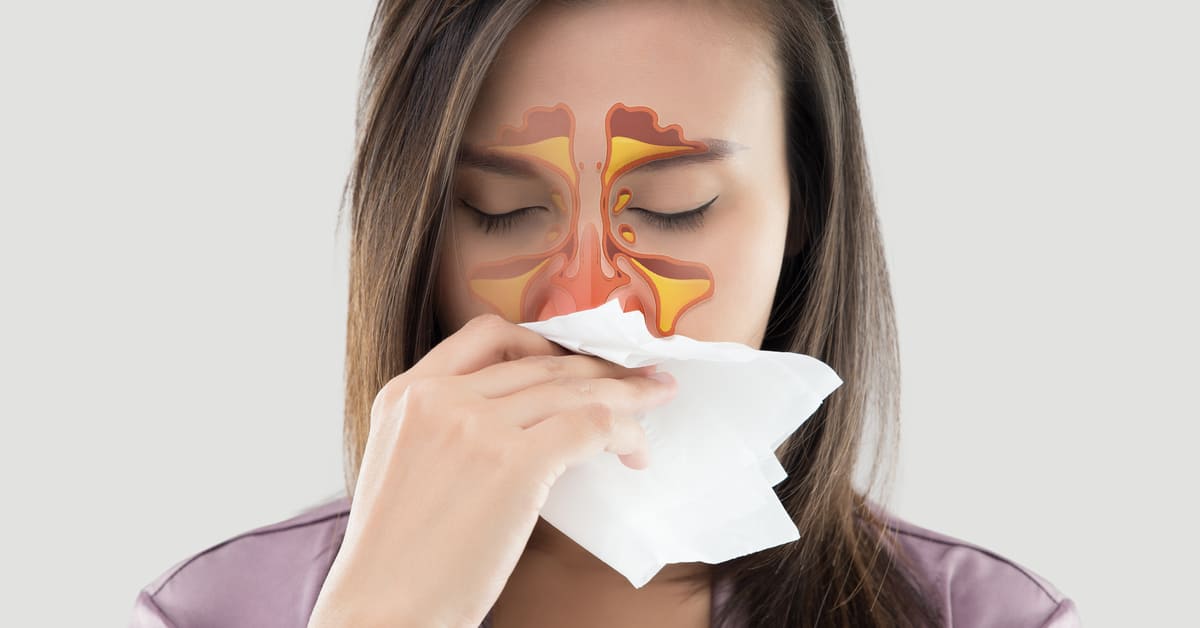 Apa Itu Sinusitis? Ini Gejala, Penyebab dan Pengobatannya