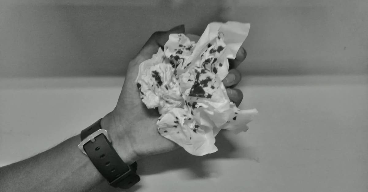 Cara Mengatasi Mimisan