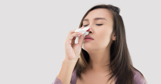 10 Penyebab Mimisan, Gejala dan Cara Mengatasinya!