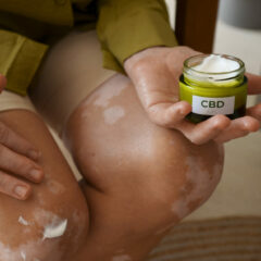 Salep Penghilang Bekas Luka: Cara Efektif Menghilangkan Bekas Luka dan Tips Memilih Produk yang Tepat