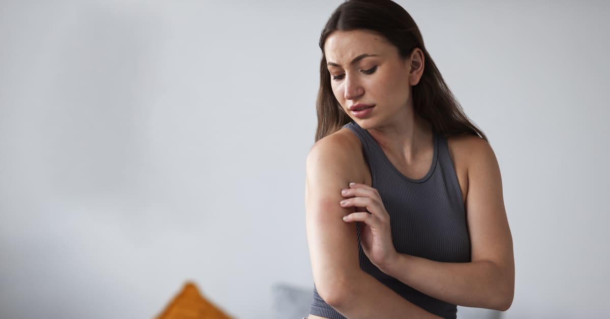 Apa Itu Biang Keringat?