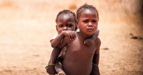 Gizi Buruk pada Anak: Penyebab, Dampak, dan Solusi