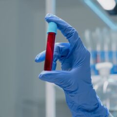 Ini Dia, Cara Menaikkan HB yang Alami dan Aman