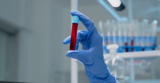 Ini Dia, Cara Menaikkan HB yang Alami dan Aman