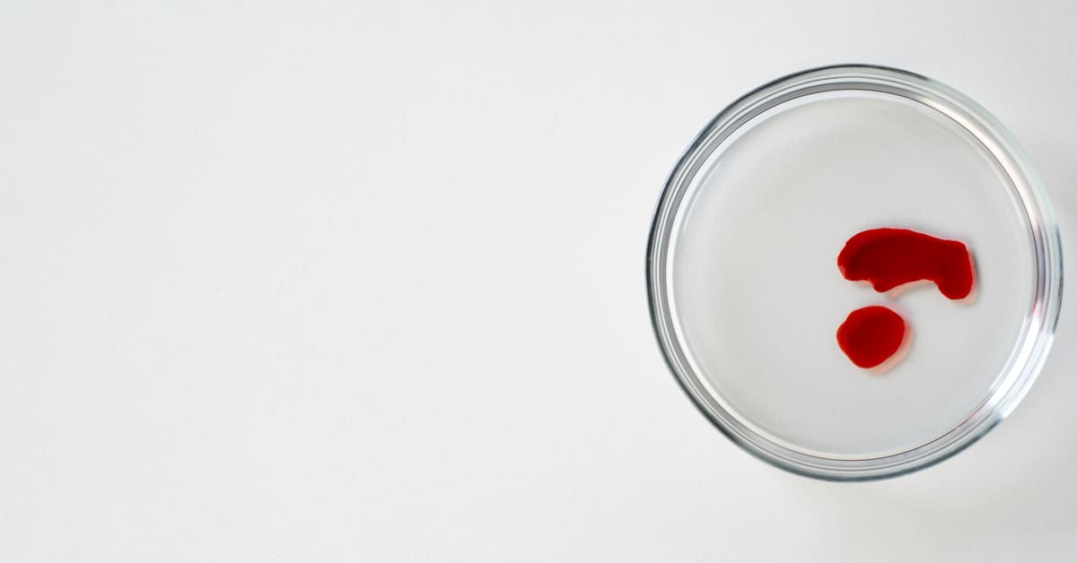 Trik Jitu Supaya Zat Besi Lebih “Nempel”