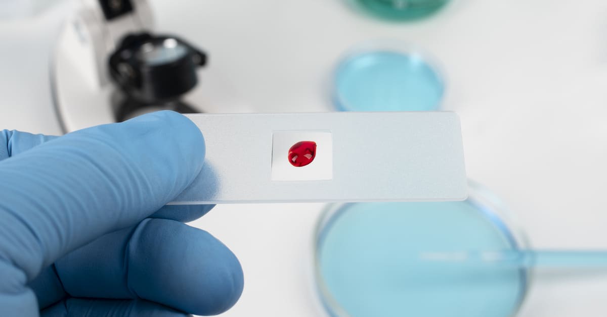 Tiga Pilar Menaikkan HB